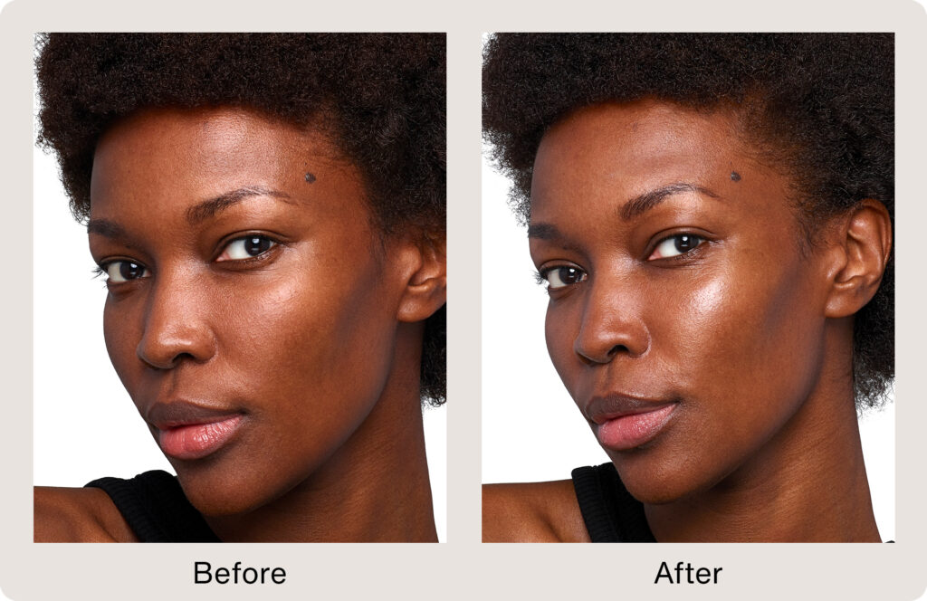Aesthetic Skin Winnetka IL Skinvive Before And After 02
