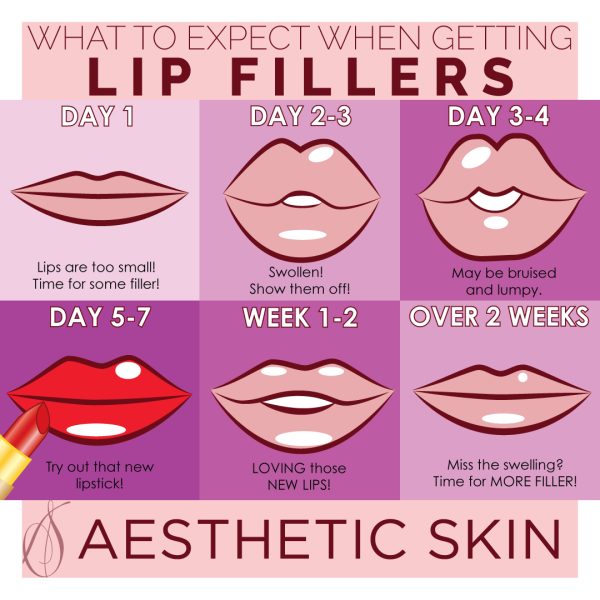 Aesthetic Skin Winnetka Fillers Lip Fillers Guide