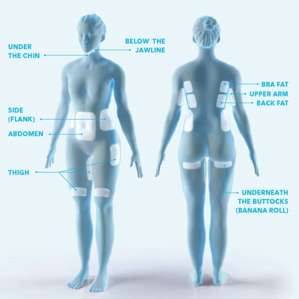 CoolSculpting-9Areas